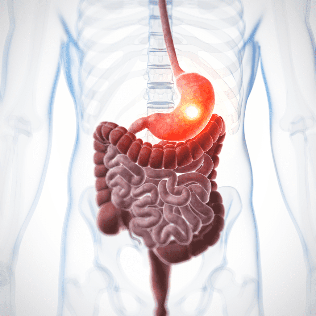kondisi visual asam lambung